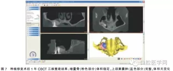 640.webp (4).jpg 640.webp (4).jpg