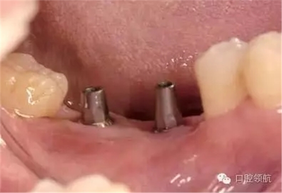 640.webp (4).jpg 640.webp (4).jpg