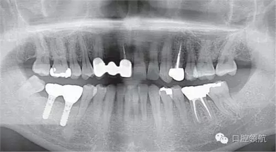 640.webp (5).jpg 640.webp (5).jpg