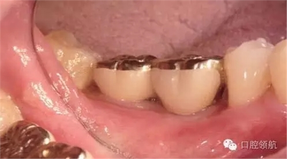 640.webp (6).jpg 640.webp (6).jpg