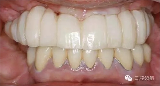 640.webp (1).jpg 640.webp (1).jpg