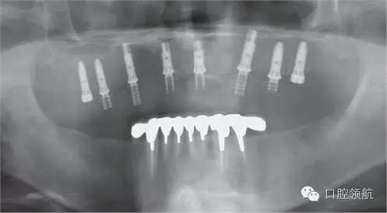 640.webp (2).jpg 640.webp (2).jpg