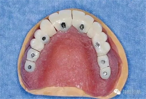 640.webp (4).jpg 640.webp (4).jpg