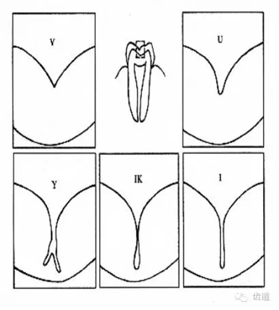 1.webp.jpg 1.webp.jpg