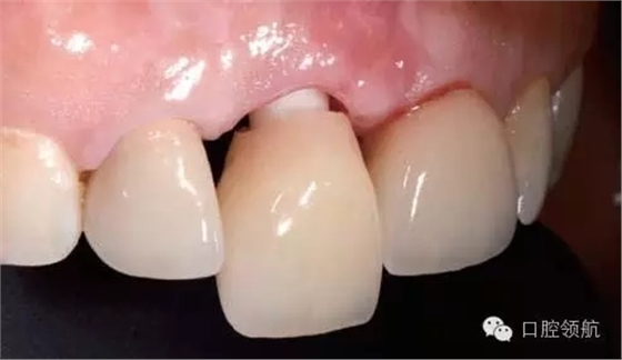 640.webp (3).jpg 640.webp (3).jpg