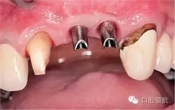 640.webp (2).jpg 640.webp (2).jpg