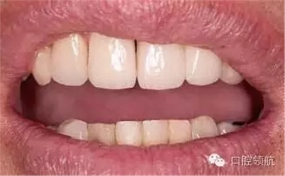 640.webp (4).jpg 640.webp (4).jpg