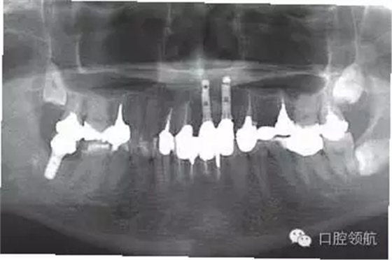 640.webp (5).jpg 640.webp (5).jpg