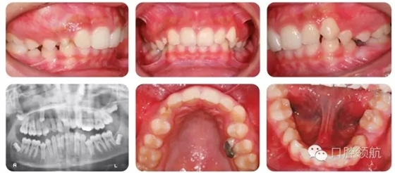 640.webp.jpg 640.webp.jpg