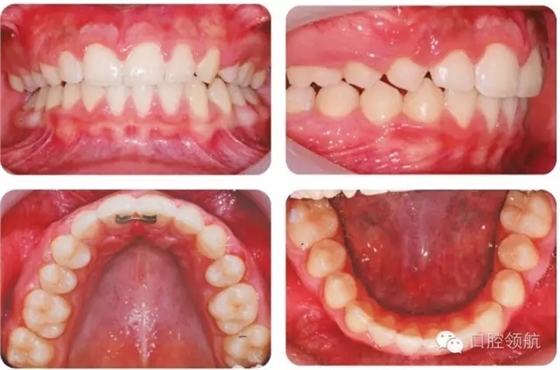 640.webp (3).jpg 640.webp (3).jpg