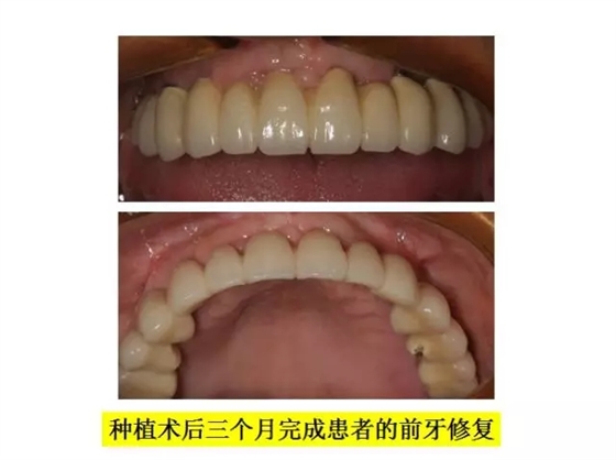 640.webp (6).jpg 640.webp (6).jpg