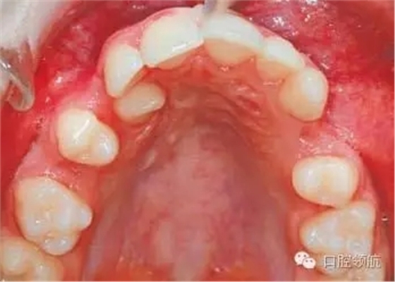 640.webp (4).jpg 640.webp (4).jpg