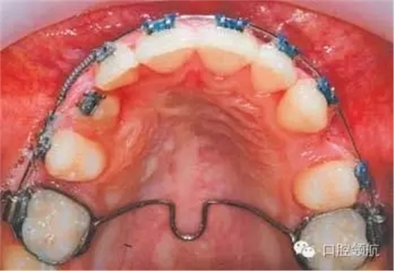 640.webp (5).jpg 640.webp (5).jpg