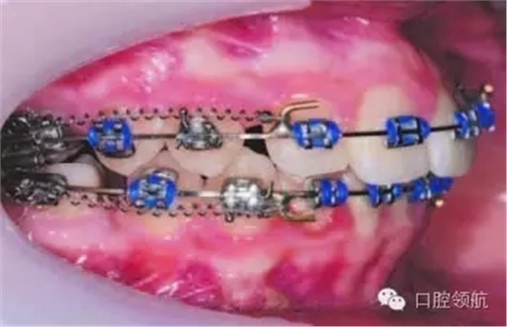 640.webp (6).jpg 640.webp (6).jpg