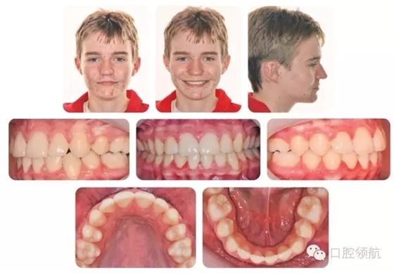 640.webp (7).jpg 640.webp (7).jpg