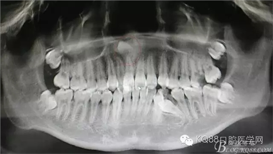 640.webp.jpg 640.webp.jpg