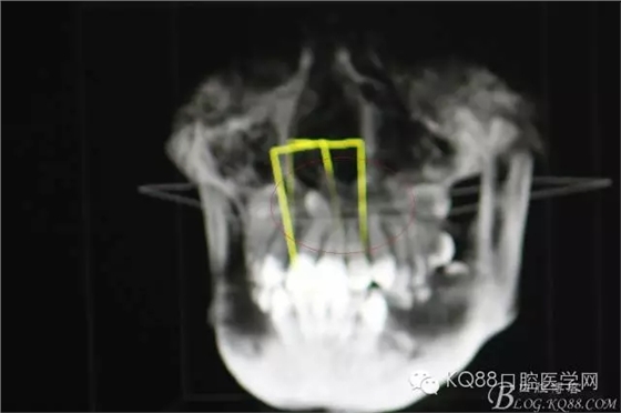 640.webp (3).jpg 640.webp (3).jpg