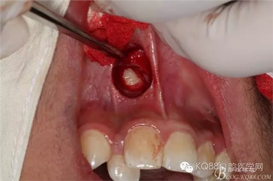 640.webp (4).jpg 640.webp (4).jpg