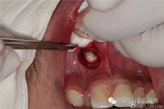 640.webp (5).jpg 640.webp (5).jpg