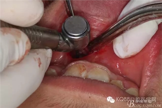 640.webp (7).jpg 640.webp (7).jpg