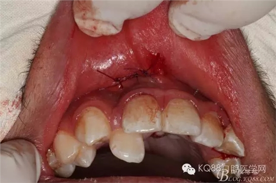 640.webp (14).jpg 640.webp (14).jpg