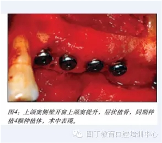 640.webp (3).jpg 640.webp (3).jpg