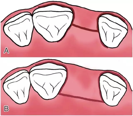 640.webp (4).jpg 640.webp (4).jpg