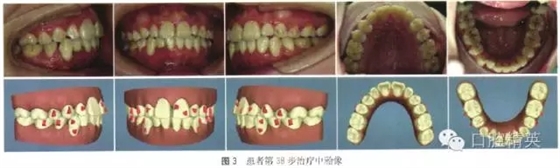 640.webp (3).jpg 640.webp (3).jpg