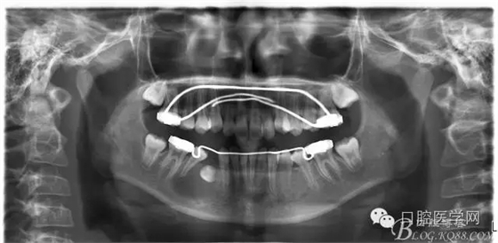 640.webp (4).jpg 640.webp (4).jpg