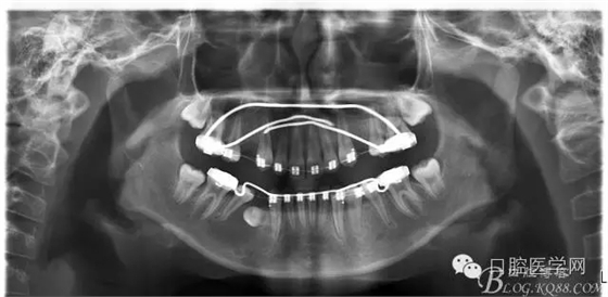 640.webp (5).jpg 640.webp (5).jpg