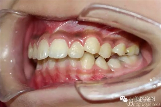 640.webp (11).jpg 640.webp (11).jpg