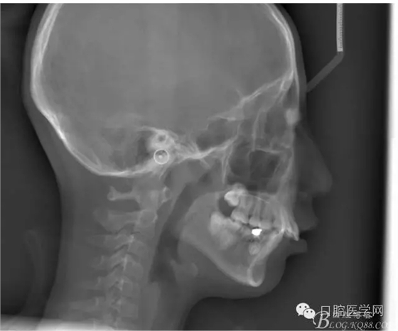 640.webp (17).jpg 640.webp (17).jpg