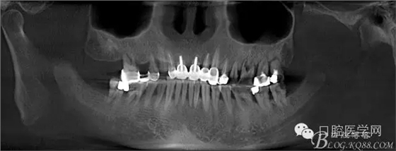 640.webp.jpg 640.webp.jpg