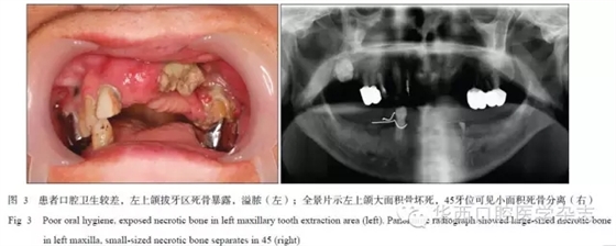 640.webp (3).jpg 640.webp (3).jpg