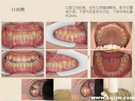 640.webp (1).jpg 640.webp (1).jpg