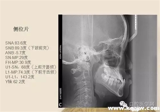 640.webp (3).jpg 640.webp (3).jpg