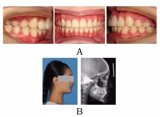 640.webp (3).jpg 640.webp (3).jpg