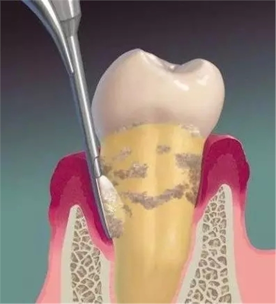 640.webp (2).jpg 640.webp (2).jpg