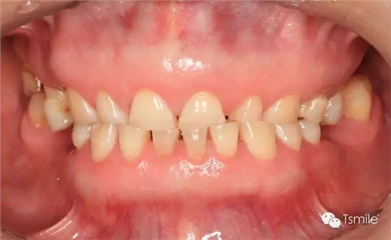 640.webp (5).jpg 640.webp (5).jpg