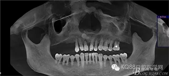 640.webp (2).jpg 640.webp (2).jpg