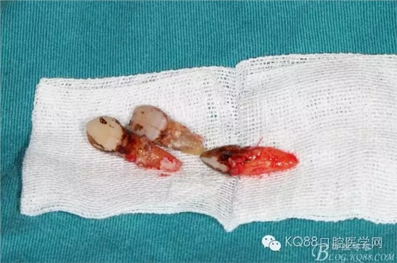 640.webp (5).jpg 640.webp (5).jpg