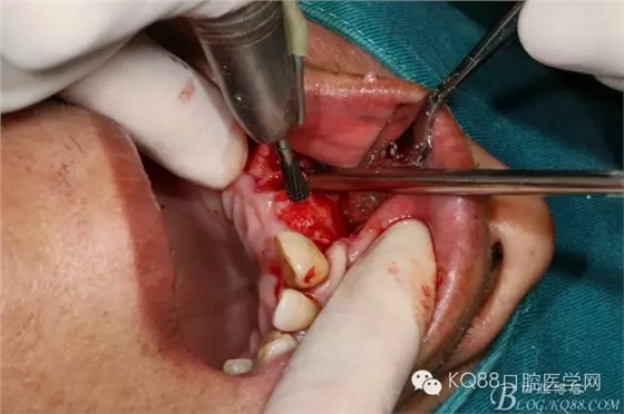 640.webp (8).jpg 640.webp (8).jpg