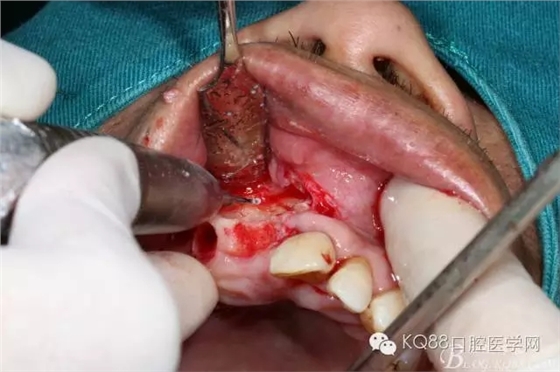 640.webp (9).jpg 640.webp (9).jpg