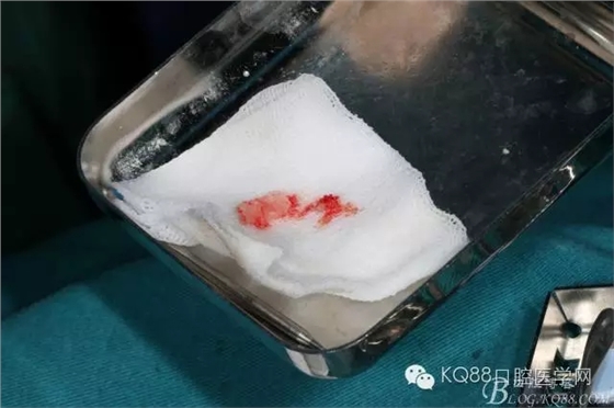 640.webp (15).jpg 640.webp (15).jpg