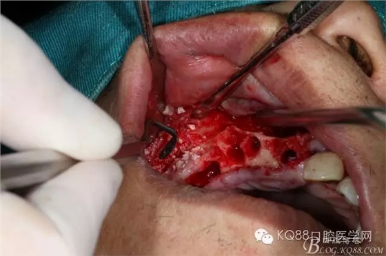 640.webp (18).jpg 640.webp (18).jpg