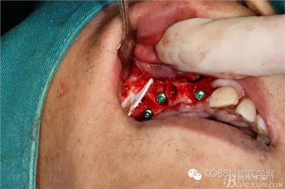 640.webp (22).jpg 640.webp (22).jpg