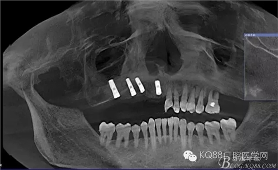 640.webp (25).jpg 640.webp (25).jpg