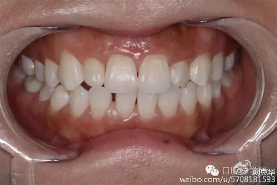 640.webp (2).jpg 640.webp (2).jpg