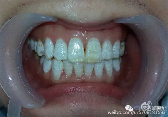 640.webp (4).jpg 640.webp (4).jpg