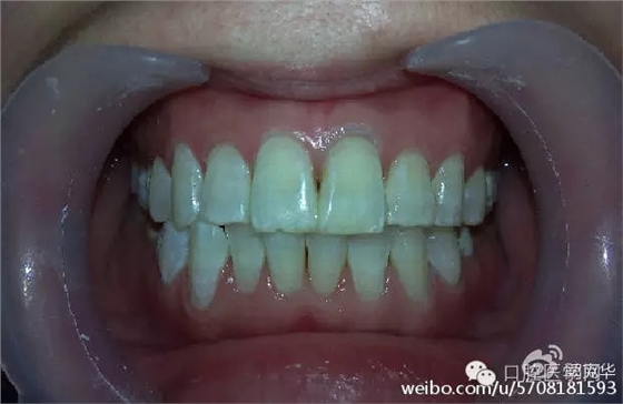 640.webp (5).jpg 640.webp (5).jpg